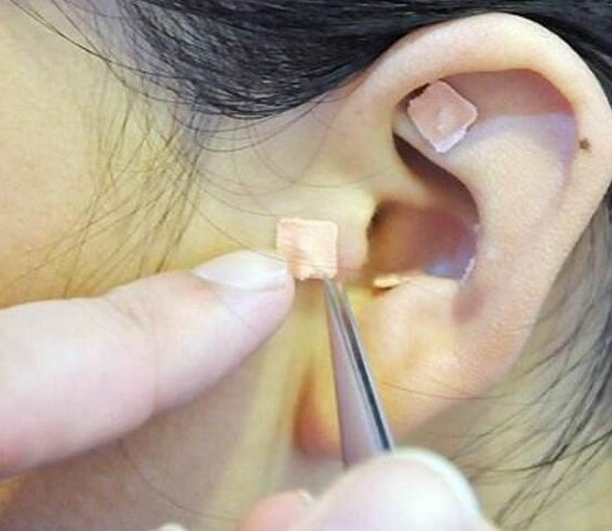 失眠|失眠不吃药,每天捏一捏耳朵,一觉睡到大天亮!