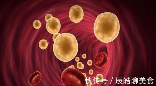 发酵液|这6种食物是天然“降脂菜”, 高血脂的人不要错过了