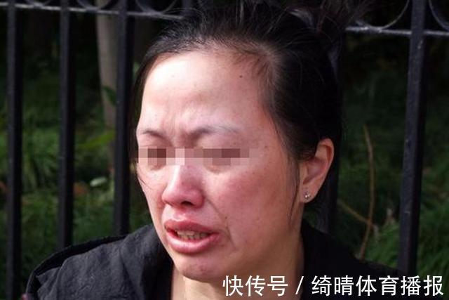 脑门封闭症|女子生下一只“猴女孩”,马戏团欲花大价钱收购,宝妈:她是孩子