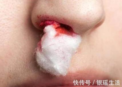 暗号|脑溢血当天，身体会发出5种暗号，记住可保命！