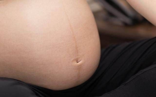 性别|孕期,孕妈的肚脐是这个形状的,那么恭喜了,可能怀的是个男宝宝