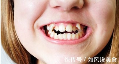 正畸|儿童做牙齿矫正三个最佳时间家长要牢记,矫治越早干预效果越好