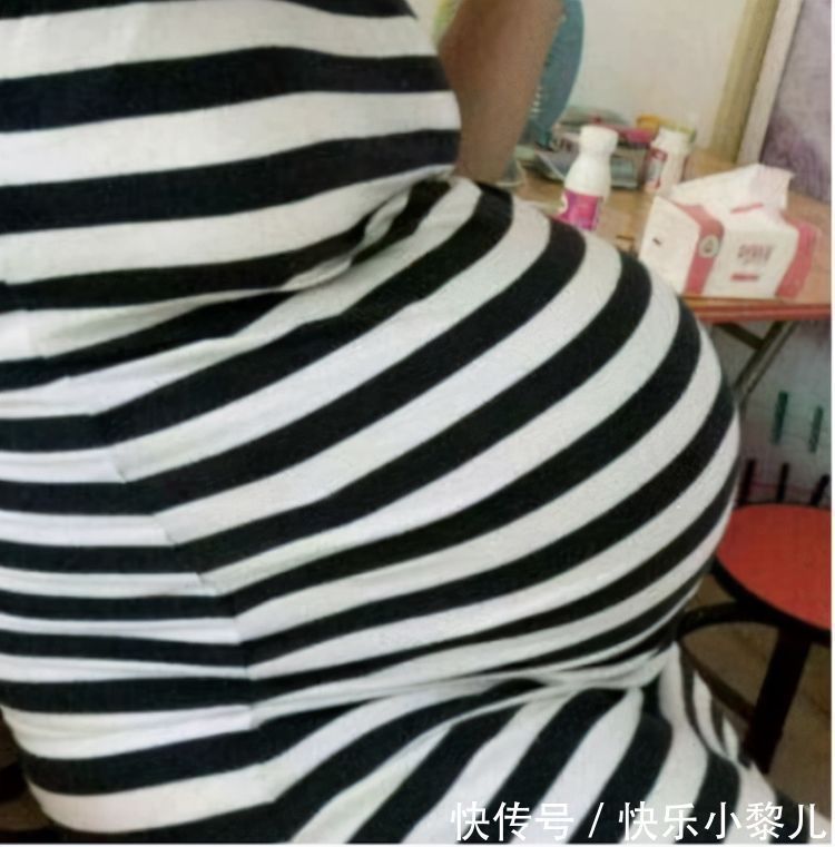 宝妈|孕妇“悬垂肚”走红,头回见到这种胎型,护士坦言:对宝妈不好