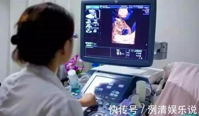 畸形|B超上孩子在做“鬼脸”,宝妈以为是调皮,医生却说孩子要不得