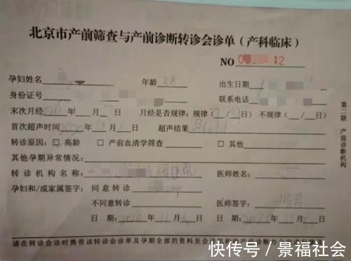 18三体综合征|我的真实经历:做了这几个产检,总结出几个经验,顺利过关