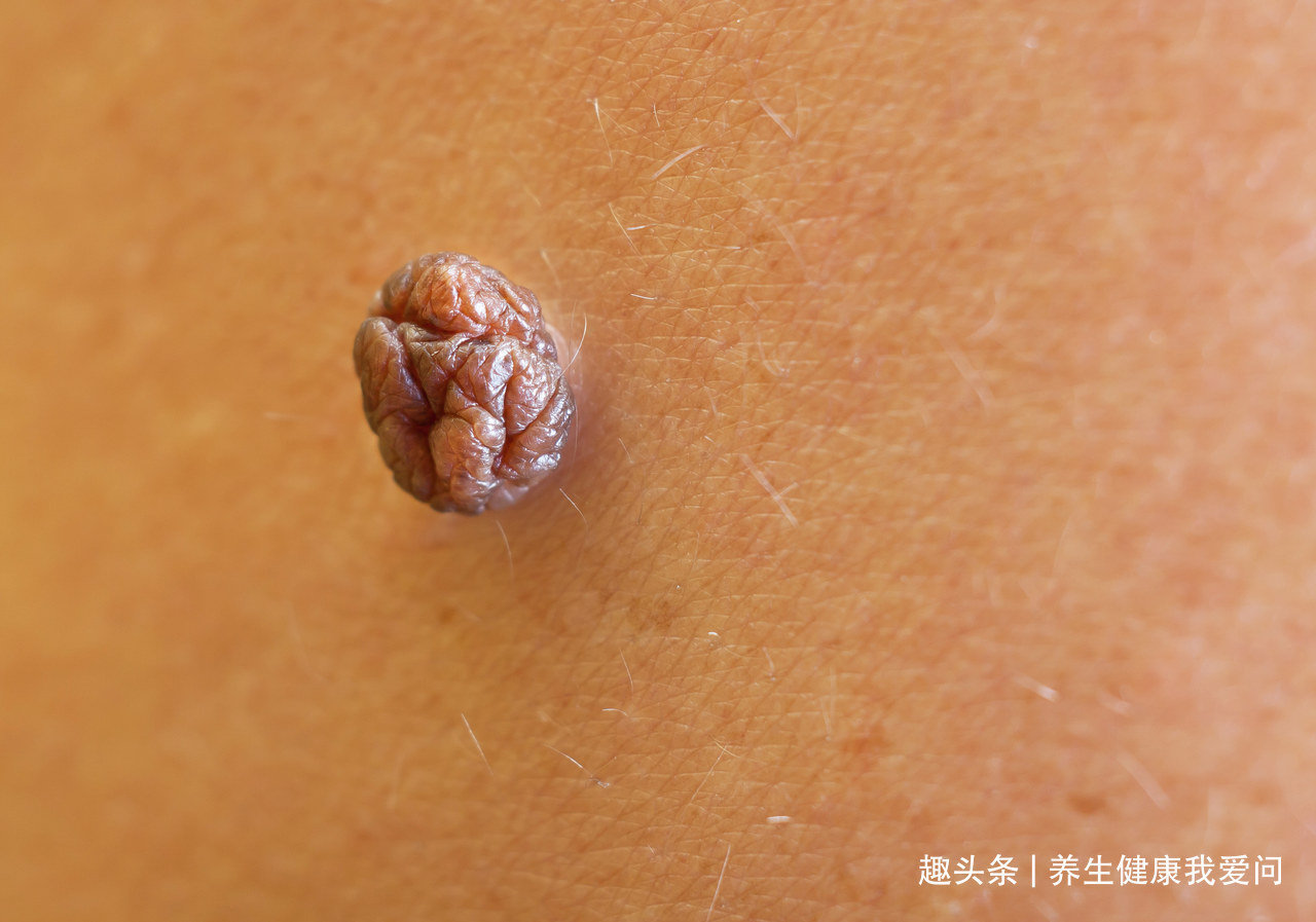 口腔溃疡|6种症状别“硬抗”，超过一定时间不愈可能是癌，建议及时就医