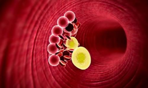 控制|50岁以上，糖尿病血糖控制多少才达标？医生：控糖目标根据指数定