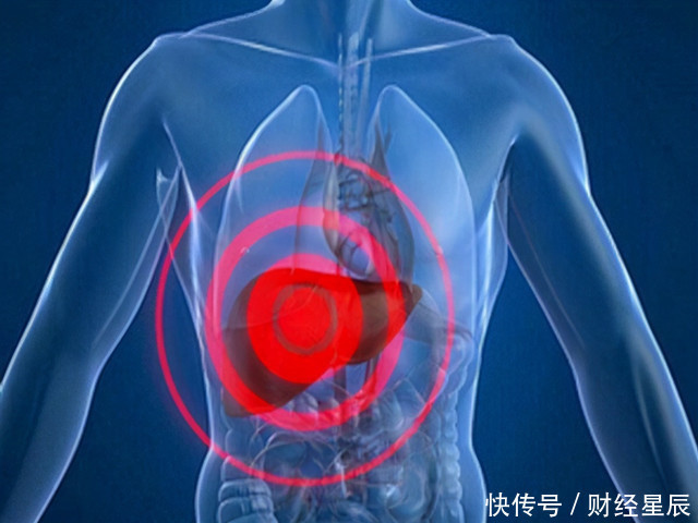  治疗|肝脏变硬，头部会频繁出现3个“极端”，早发现早治疗