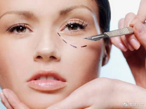 去眼袋术后多久能恢复？多久能消肿？