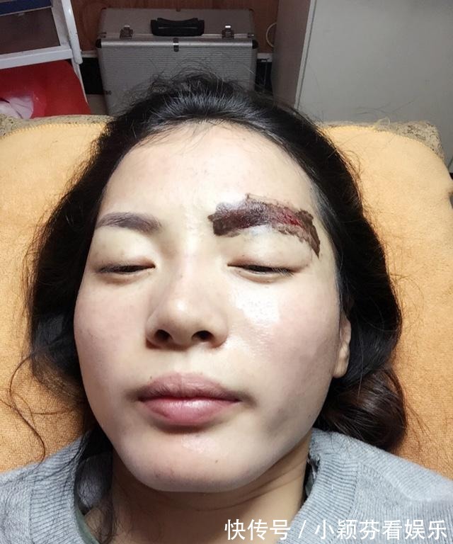 纹眉师|为什么医生不提倡女生“纹眉”?三个理由告诉你原因,幸好没跟风