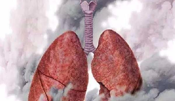 瘙痒|你的肺部是否健康几个小运动自测一下,省得去做体检了