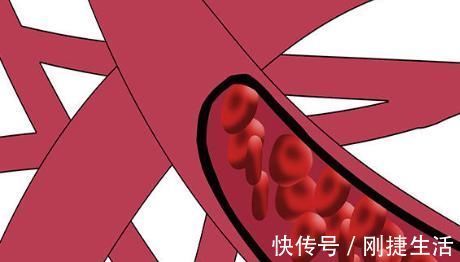 血管|吃洋葱真的可以疏通血管吗?一直搞错了,此样做血管才会更健康