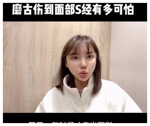 真实颜值|美女网红花70万却整形失败,磨骨伤到神经毁容,自叹非常后悔