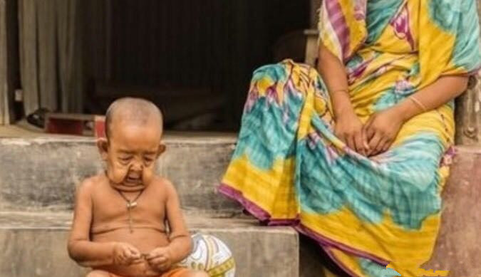 印度|印度13岁少女嫁给亲哥哥，当他们孩子出生后，一家人大闹医院