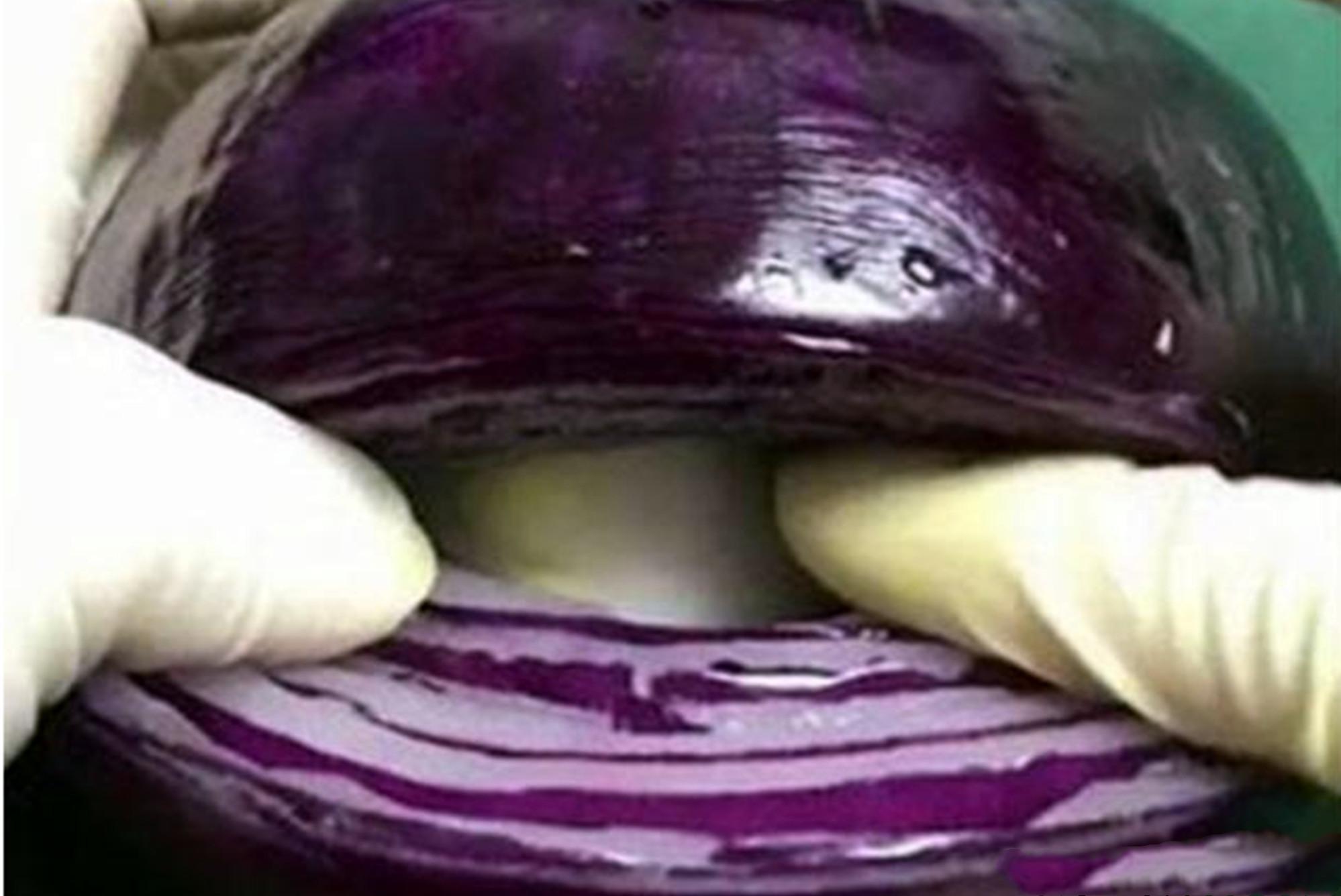 竖刀|“我没说要竖刀啊”，为什么剖腹产医院默认竖刀女性要提前了解