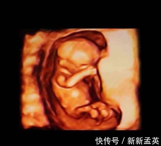 胚胎|胎儿从卵泡到性别形成,17张图片清晰诠释,男宝女宝看得很清楚