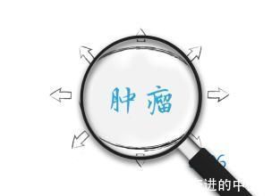 成都中医肿瘤医院|成都中医肿瘤医院:肿瘤家属在对患者进行护理时,要做到3个不要