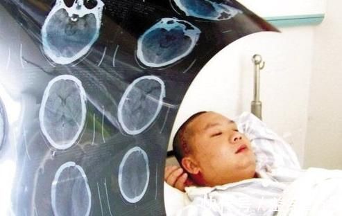 专家|去医院做CT检查会致癌究竟是做还是不做看看专家是怎么说