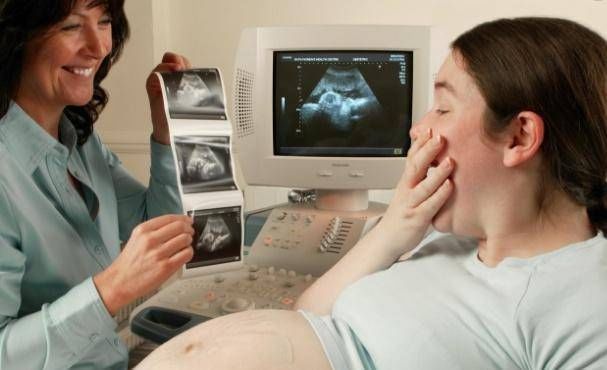 产检|产检时，为什么会问是头胎还是二胎头胎和二胎的区别你了解多少