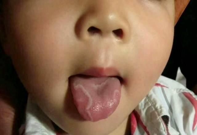 身高|12岁男孩一年长高20公分，医生直言：此物是身高“催化剂”可多吃