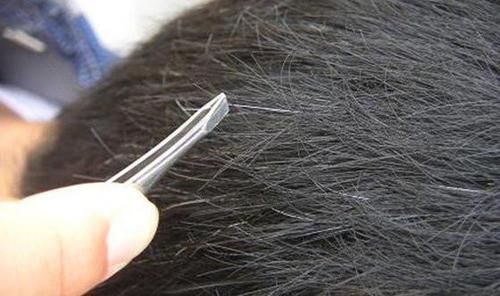 寿命长的人,身上这4处不会发白,如果你没占,或许是老得慢体质!