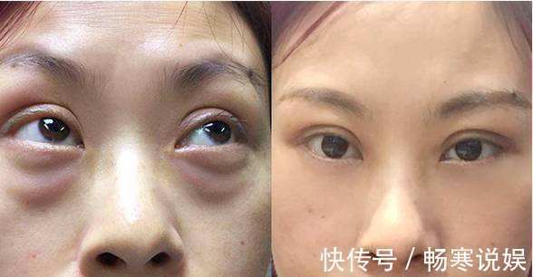 何首乌|三味药泡茶喝,坚持半个月,黑眼圈、眼袋通通全消失,越变越美