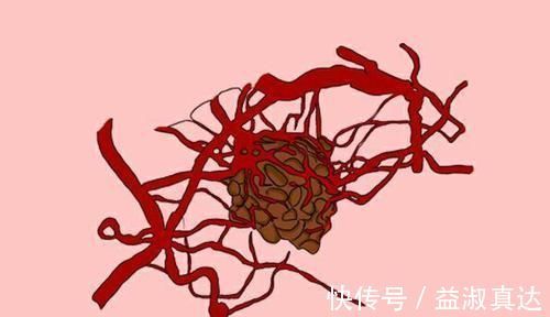 小名|得癌后,为何有人一化疗就没了?化疗到底该不该做?医生解答