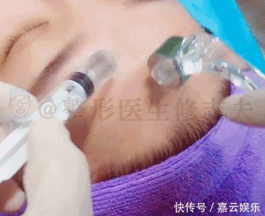 收敛毛孔，除了光子嫩肤，这两种方法也很出色