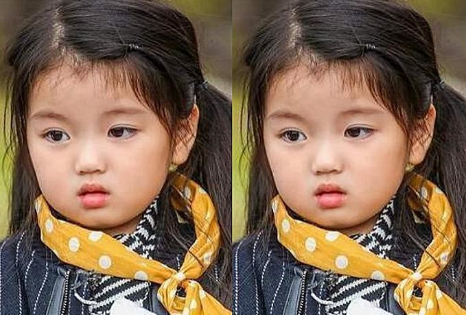 禁止整容|曾經被全網“禁止整容”的阿拉蕾，如今變成這副模樣，美到不敢認