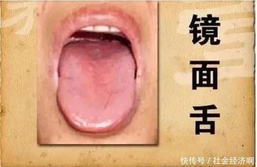 二陈丸一个能让身体“脱胎换骨”的千年古方,这个夏天很需要