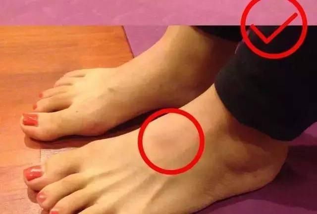 英雄|瑜伽英雄坐:脚踝疼,膝盖不舒服,臀部坐不下去,怎么办?