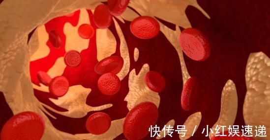 血液|血液“净化器”被发现，预防高血脂、血栓，血管被“扫”干净了！