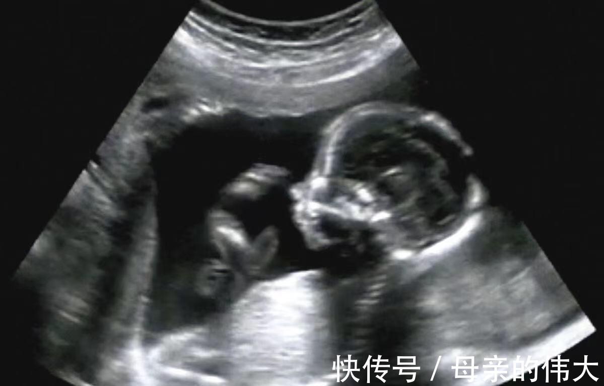 孕期|孕期四维彩超，准妈妈第一次见到宝宝的样子，那些准备你做好没