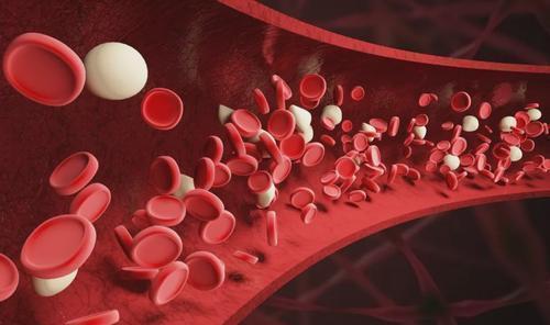 面条|血脂偏高的人,不能吃面条吗?3种素食请管住嘴,别不当回事