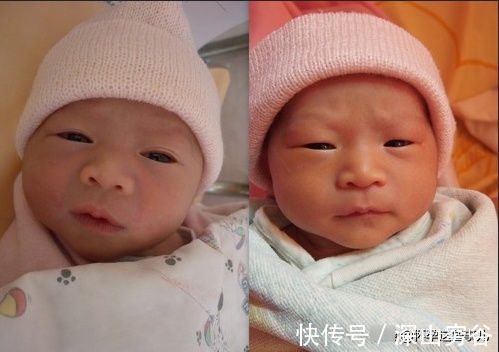 软便剂|终于卸货啦!让我不敢再回想的双胞胎待产和生产记录,住进ICU