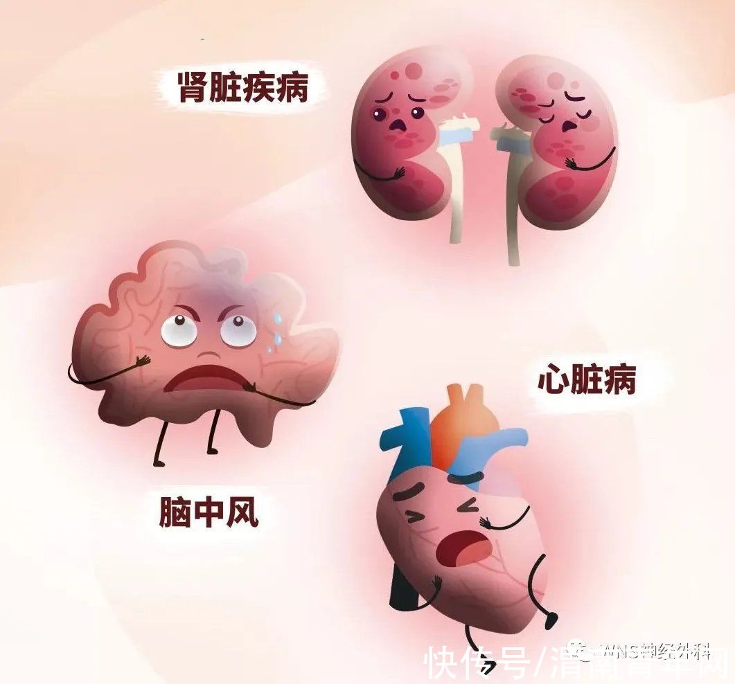 渭南市第二医院|渭南市第二医院神经脊柱外科：高血压患者最关心的10个问题