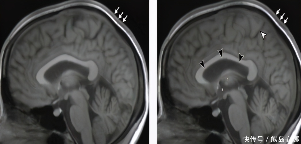马斯克“外星移民梦”垮了?11名宇航员基因突变,生育后代风险大