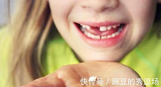 恒牙|孩子乳牙整齐漂亮,换牙后却越来越歪?可能是这几点没做好