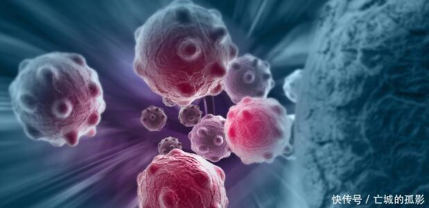 治疗|癌症治疗后,为什么如此容易转移和复发请记住12条抗癌“妙招”