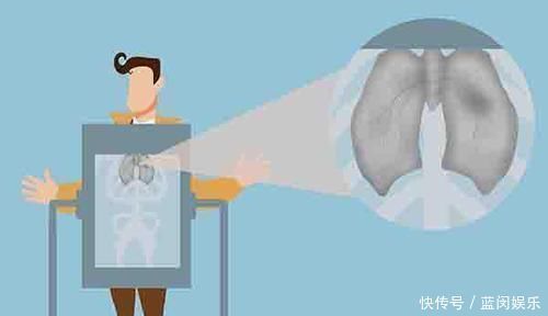 在哪些时间段抽烟,对肺部会造成翻倍的伤害烟瘾再大也要忍住