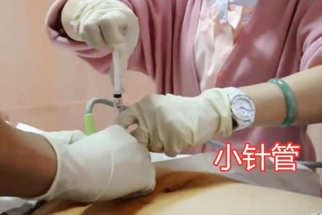 羊水穿刺|准妈妈做“羊水穿刺”现场,老公默默的喊加油,而妈妈已哭成泪人