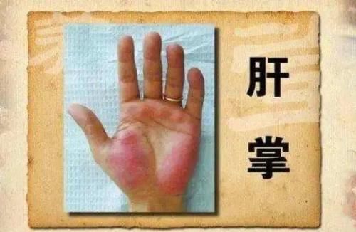 一天到晚总是放屁，别忽视，或许不是肠胃问题