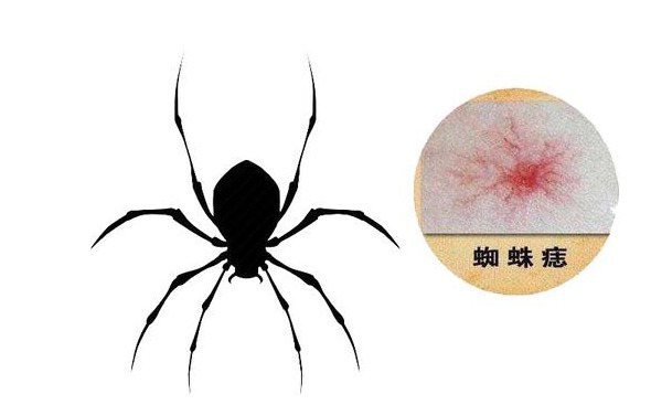 信号|肝癌一发现就是晚期?4个信号别大意,肝部或正遭受癌细胞侵袭