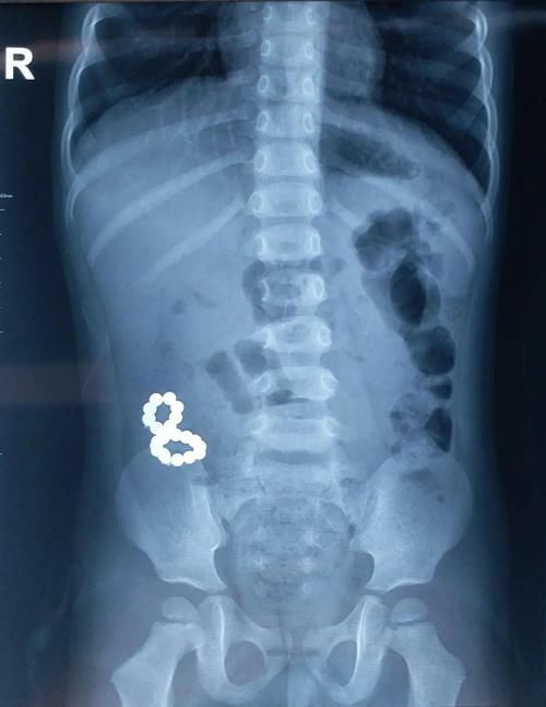 兰兰|别让所谓的“益智”玩具,毁掉孩子的健康