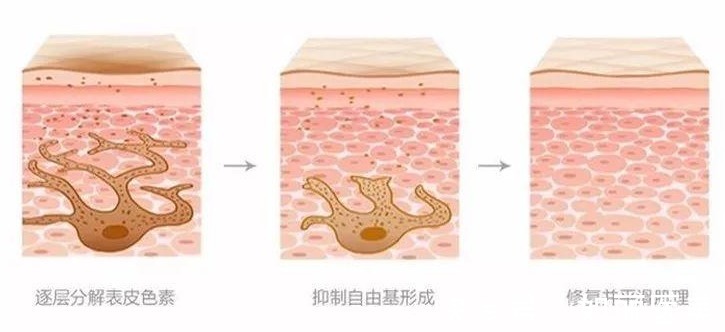 如果爱 深扒!超光子和光子嫩肤的区别,你更适合哪一种呢?