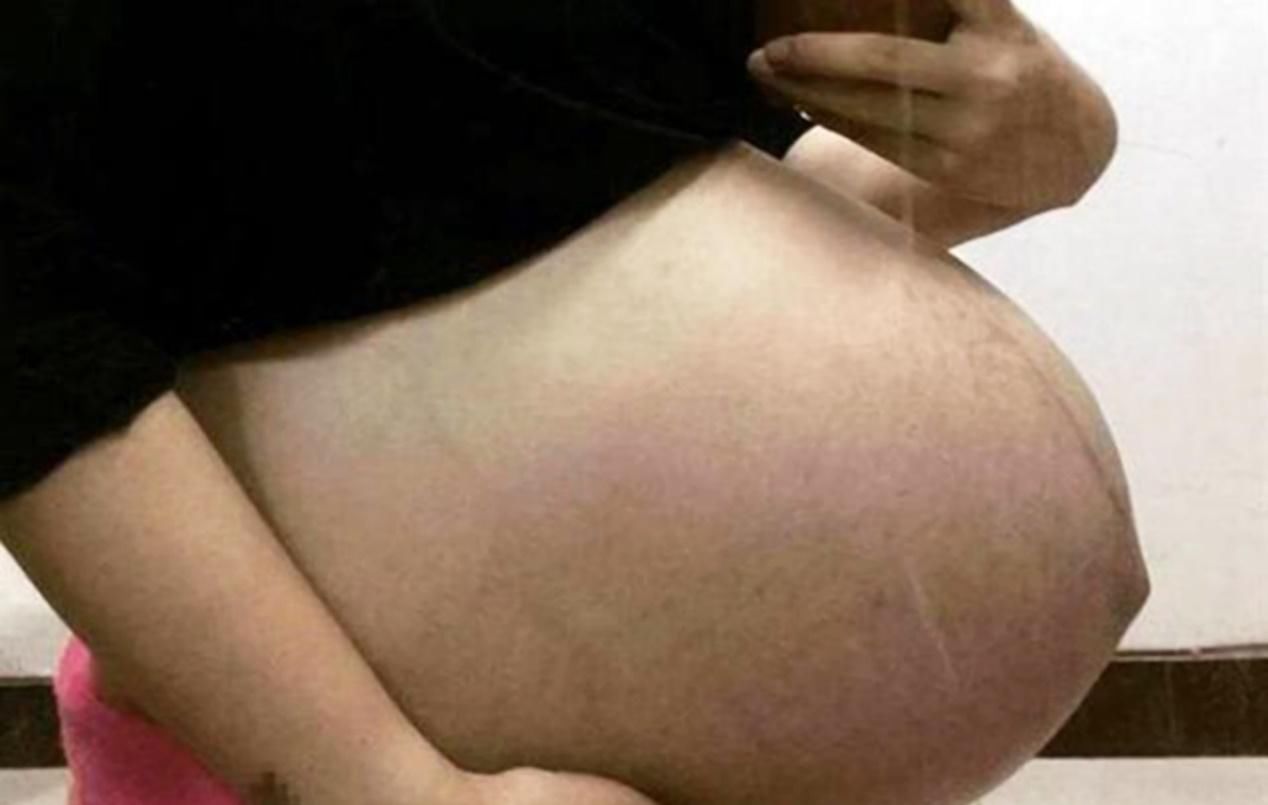 二胎政策|女性怀第三胎的肚子有什么变化？翻开衣服后，宝爸沉默了