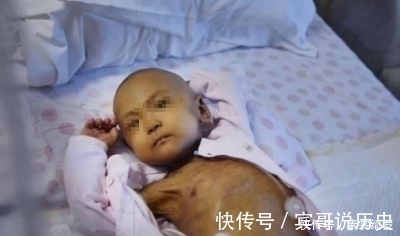 泪目|3岁女孩瘦的跟骷髅一样,天天喊饿父母却不给吃,真相让人泪目