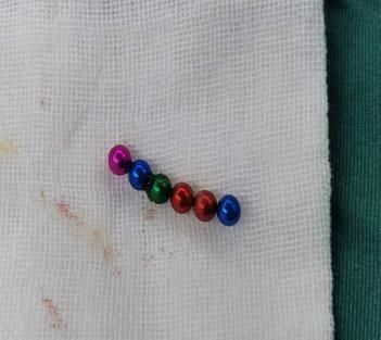 急诊科医生|2岁男孩肠子破了8处,竟是这东西惹的祸!很多人家里都有