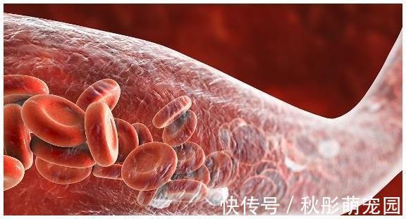 三酰甘油|血脂高的人,别怕,这3种食物,坚持早晚吃一点,血脂慢慢降下去