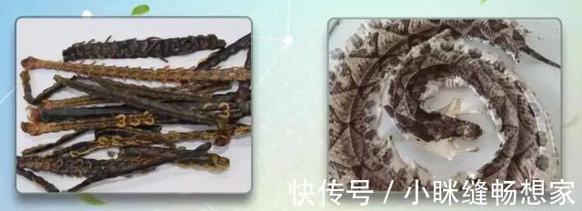 中风病|牢记中风9大先兆,识别中风只需10秒!1个妙招,远离中风